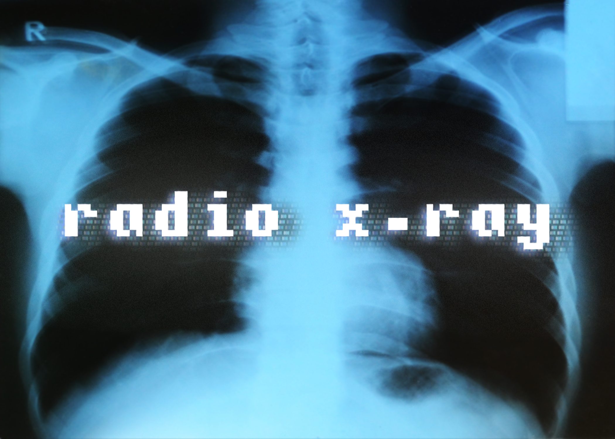 Radio X-Ray Show Logo